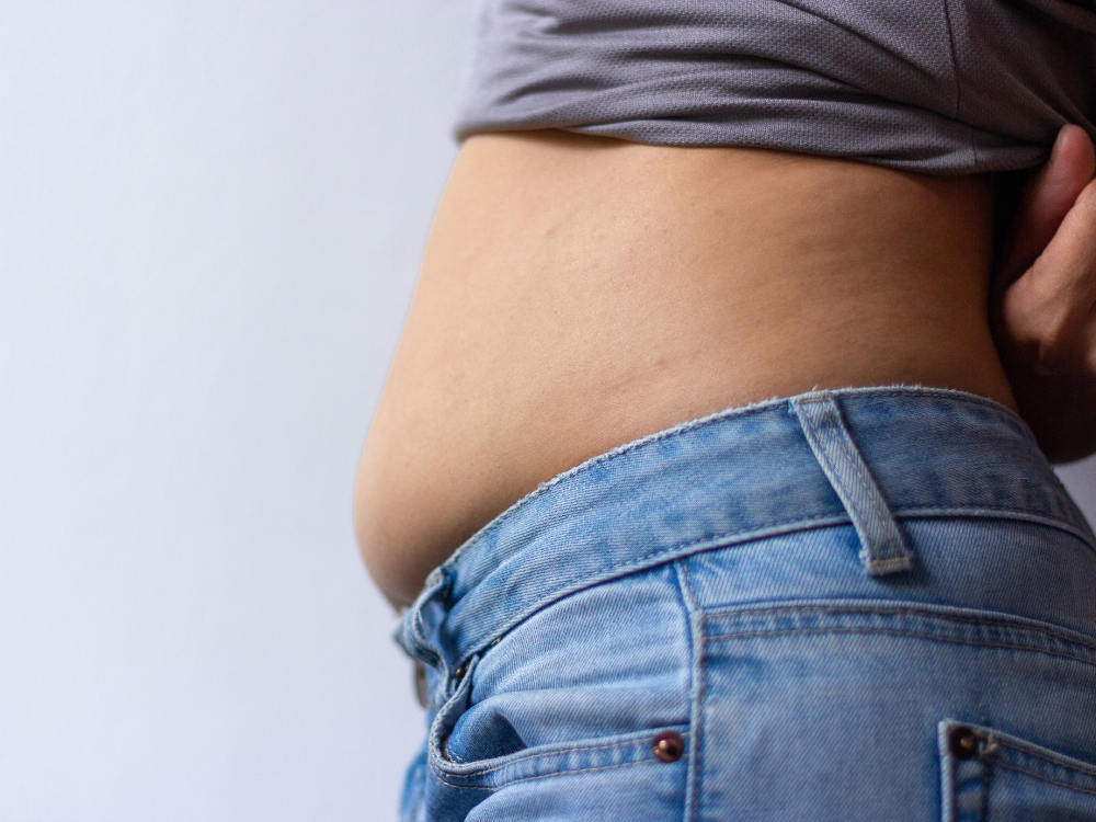 内臓脂肪の蓄積したお腹